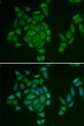 AMPD3 Antibody - Immunofluorescence analysis of HeLa cells using AMPD3 Polyclonal Antibody.
