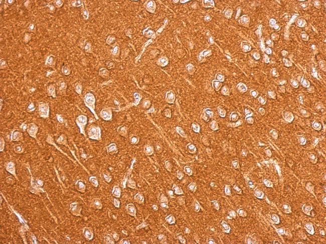AMPH / Amphiphysin Antibody - Amphiphysin antibody [N1N2], N-term detects AMPH protein at cytosol on mouse brain by immunohistochemical analysis. Sample: Paraffin-embedded mouse brain. Amphiphysin antibody [N1N2], N-term dilution:1:500.