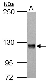 AMPH / Amphiphysin Antibody - Amphiphysin antibody [N1N2], N-term detects AMPH protein by Western blot analysis. A. 50 ug rat brain lysate/extract. 5 % SDS-PAGE. Amphiphysin antibody [N1N2], N-term dilution:1:500