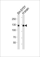 AMPH / Amphiphysin Antibody - Western blot of lysates from SH-SY5Y cell line, human brain tissue lysate (from left to right), using AMPH antibody diluted at 1:1000 at each lane. A goat anti-rabbit IgG H&L (HRP) at 1:10000 dilution was used as the secondary antibody. Lysates at 20 ug per lane.
