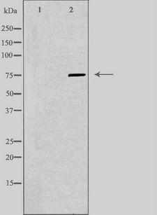 AMPH / Amphiphysin Antibody - Western blot analysis of extracts of HeLa cells using AMPH antibody. The lane on the left is treated with the antigen-specific peptide.