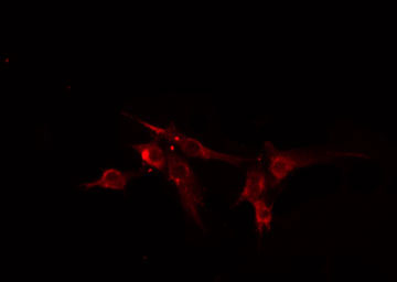 AMPH / Amphiphysin Antibody - Staining HeLa cells by IF/ICC. The samples were fixed with PFA and permeabilized in 0.1% Triton X-100, then blocked in 10% serum for 45 min at 25°C. The primary antibody was diluted at 1:200 and incubated with the sample for 1 hour at 37°C. An Alexa Fluor 594 conjugated goat anti-rabbit IgG (H+L) antibody, diluted at 1/600, was used as secondary antibody.