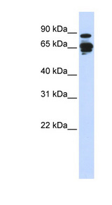 AMPH / Amphiphysin Antibody - AMPH / Amphiphysin antibody Western blot of 293T cell lysate. This image was taken for the unconjugated form of this product. Other forms have not been tested.