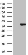 AMT Antibody - HEK293T cells were transfected with the pCMV6-ENTRY control (Left lane) or pCMV6-ENTRY AMT (Right lane) cDNA for 48 hrs and lysed. Equivalent amounts of cell lysates (5 ug per lane) were separated by SDS-PAGE and immunoblotted with anti-AMT (1:2000).