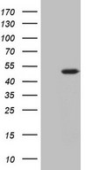 AMT Antibody - HEK293T cells were transfected with the pCMV6-ENTRY control. (Left lane) or pCMV6-ENTRY AMT. (Right lane) cDNA for 48 hrs and lysed. Equivalent amounts of cell lysates. (5 ug per lane) were separated by SDS-PAGE and immunoblotted with anti-AMT. (1:2000)
