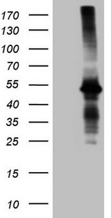 AMT Antibody - HEK293T cells were transfected with the pCMV6-ENTRY control. (Left lane) or pCMV6-ENTRY AMT. (Right lane) cDNA for 48 hrs and lysed