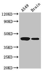 AMT Antibody - Western Blot Positive WB detected in: A549 whole cell lysate, Mouse brain tissue All lanes: AMT antibody at 3.5µg/ml Secondary Goat polyclonal to rabbit IgG at 1/50000 dilution Predicted band size: 44, 38, 40, 42 kDa Observed band size: 44 kDa