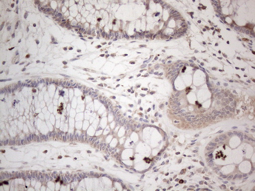 AMTN Antibody - Immunohistochemical staining of paraffin-embedded Human colon tissue within the normal limits using anti-AMTN mouse monoclonal antibody. (Heat-induced epitope retrieval by 1mM EDTA in 10mM Tris buffer. (pH8.5) at 120°C for 3 min. (1:150)