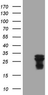 AMTN Antibody - HEK293T cells were transfected with the pCMV6-ENTRY control (Left lane) or pCMV6-ENTRY AMTN (Right lane) cDNA for 48 hrs and lysed. Equivalent amounts of cell lysates (5 ug per lane) were separated by SDS-PAGE and immunoblotted with anti-AMTN (1:2000).