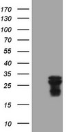 AMTN Antibody - HEK293T cells were transfected with the pCMV6-ENTRY control (Left lane) or pCMV6-ENTRY AMTN (Right lane) cDNA for 48 hrs and lysed. Equivalent amounts of cell lysates (5 ug per lane) were separated by SDS-PAGE and immunoblotted with anti-AMTN (1:2000).