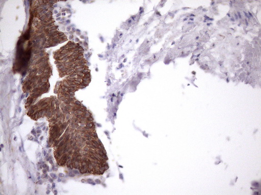 AMTN Antibody - Immunohistochemical staining of paraffin-embedded Human prostate tissue within the normal limits using anti-AMTN mouse monoclonal antibody. (Heat-induced epitope retrieval by 1mM EDTA in 10mM Tris buffer. (pH8.5) at 120 oC for 3 min. (1:150)