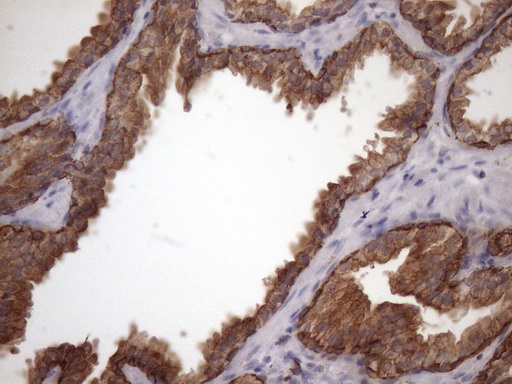 AMTN Antibody - Immunohistochemical staining of paraffin-embedded Human bladder tissue within the normal limits using anti-AMTN mouse monoclonal antibody. (Heat-induced epitope retrieval by 1mM EDTA in 10mM Tris buffer. (pH8.5) at 120 oC for 3 min. (1:150)