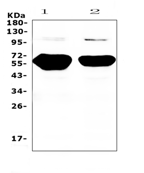 AMY1A + AMY1B + AMY1 Antibody - Western blot analysis of Alpha Amylase 1 using anti-Alpha Amylase 1 antibody. Electrophoresis was performed on a 5-20% SDS-PAGE gel at 70V (Stacking gel) / 90V (Resolving gel) for 2-3 hours. The sample well of each lane was loaded with 50ug of sample under reducing conditions. Lane 1: rat pancreas tissue lysates, Lane 2: mouse pancreas tissue lysates. After Electrophoresis, proteins were transferred to a Nitrocellulose membrane at 150mA for 50-90 minutes. Blocked the membrane with 5% Non-fat Milk/ TBS for 1.5 hour at RT. The membrane was incubated with rabbit anti-Alpha Amylase 1 antigen affinity purified polyclonal antibody at 0.5 µg/mL overnight at 4°C, then washed with TBS-0.1% Tween 3 times with 5 minutes each and probed with a goat anti-rabbit IgG-HRP secondary antibody at a dilution of 1:10000 for 1.5 hour at RT. The signal is developed using an Enhanced Chemiluminescent detection (ECL) kit with Tanon 5200 system. A specific band was detected for Alpha Amylase 1 at approximately 58KD. The expected band size for Alpha Amylase 1 is at 58KD.