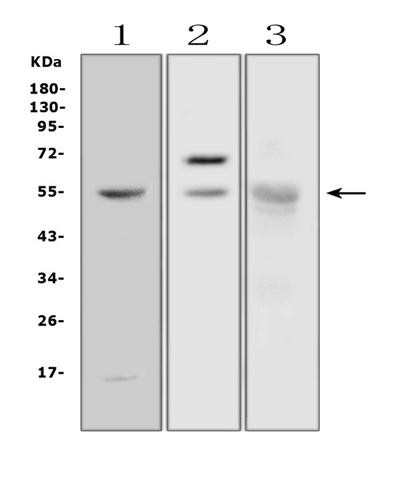 AMY1A / Salivary Amylase Antibody - Western blot analysis of Alpha Amylase 1 using anti-Alpha Amylase 1 antibody. Electrophoresis was performed on a 5-20% SDS-PAGE gel at 70V (Stacking gel) / 90V (Resolving gel) for 2-3 hours. The sample well of each lane was loaded with 50ug of sample under reducing conditions. Lane 1: human PANC-1 whole cell lysates, Lane 2: rat pancreas tissue lysates, Lane 3: mouse pancreas tissue lysates. After Electrophoresis, proteins were transferred to a Nitrocellulose membrane at 150mA for 50-90 minutes. Blocked the membrane with 5% Non-fat Milk/ TBS for 1.5 hour at RT. The membrane was incubated with rabbit anti-Alpha Amylase 1 antigen affinity purified polyclonal antibody at 0.5 µg/mL overnight at 4°C, then washed with TBS-0.1% Tween 3 times with 5 minutes each and probed with a goat anti-rabbit IgG-HRP secondary antibody at a dilution of 1:10000 for 1.5 hour at RT. The signal is developed using an Enhanced Chemiluminescent detection (ECL) kit with Tanon 5200 system. A specific band was detected for Alpha Amylase 1 at approximately 55-58KD. The expected band size for Alpha Amylase 1 is at 58KD.