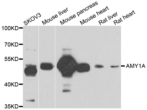 AMY1A / Salivary Amylase Antibody - Western blot analysis of extracts of various cell lines.