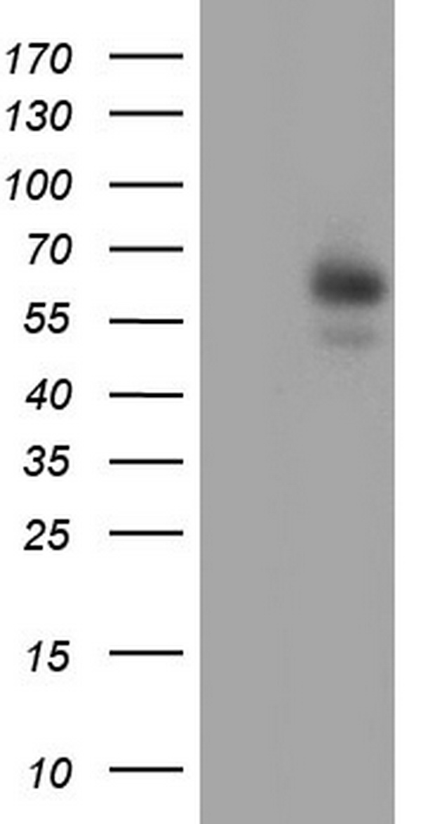 AMY2A / Pancreatic Amylase Antibody - HEK293T cells were transfected with the pCMV6-ENTRY control. (Left lane) or pCMV6-ENTRY AMY2A. (Right lane) cDNA for 48 hrs and lysed. Equivalent amounts of cell lysates. (5 ug per lane) were separated by SDS-PAGE and immunoblotted with anti-AMY2A.