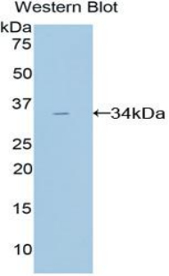 AMY2A / Pancreatic Amylase Antibody - Western blot of recombinant AMY2A / Pancreatic Amylase.  This image was taken for the unconjugated form of this product. Other forms have not been tested.