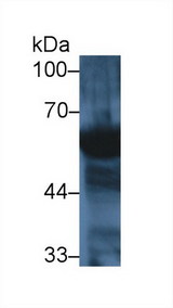 AMY2A / Pancreatic Amylase Antibody - Western Blot; Sample: Human Saliva; Primary Ab: 1µg/ml Rabbit Anti-Mouse AMY2 Antibody Second Ab: 0.2µg/mL HRP-Linked Caprine Anti-Rabbit IgG Polyclonal Antibody