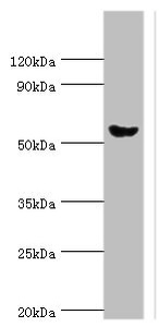 AMY2A / Pancreatic Amylase Antibody - Western blot All lanes: Pancreatic alpha-amylase antibody at 6µg/ml + Mouse liver tissue Secondary Goat polyclonal to rabbit IgG at 1/10000 dilution Predicted band size: 58, 31 kDa Observed band size: 58 kDa