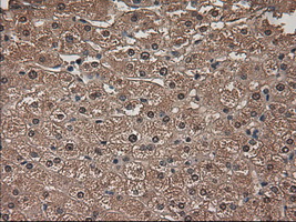 AMY2A / Pancreatic Amylase Antibody - IHC of paraffin-embedded liver using anti-AMY2A mouse monoclonal antibody.