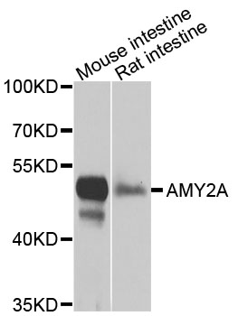 AMY2A / Pancreatic Amylase Antibody - Western blot analysis of extracts of various cells.