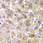 AMY2A / Pancreatic Amylase Antibody - Immunohistochemistry of paraffin-embedded human liver injury tissue.