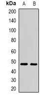 AMY2A / Pancreatic Amylase Antibody - Western blot analysis of AMY2A expression in mouse intestine (A); rat intestine (B) whole cell lysates.
