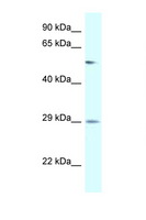 AMY2B Antibody - AMY2B antibody Western blot of Placenta lysate. Antibody concentration 1 ug/ml.  This image was taken for the unconjugated form of this product. Other forms have not been tested.