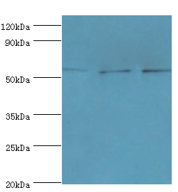 AMY2B Antibody - Western blot. All lanes: Alpha-amylase 2B antibody at 8 ug/ml. Lane 1: mouse skeletal muscle tissue. Lane 2: HL-60 whole cell lysate. Lane 3: K562 whole cell lysate. secondary Goat polyclonal to rabbit at 1:10000 dilution. Predicted band size: 58 kDa. Observed band size: 58 kDa.