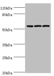 AMY2B Antibody - Western blot All lanes: Alpha-amylase 2B antibody at 8µg/ml Lane 1: Mouse skeletal muscle tissue Lane 2: HL60 whole cell lysate Lane 3: K562 whole cell lysate Secondary Goat polyclonal to rabbit IgG at 1/10000 dilution Predicted band size: 58, 43 kDa Observed band size: 58 kDa