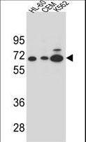 AMY2B Antibody - AMY2B Antibody western blot of HL-60,CEM and K562 cell line lysates (35 ug/lane). The AMY2B antibody detected the AMY2B protein (arrow).