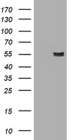 AMY2B Antibody - HEK293T cells were transfected with the pCMV6-ENTRY control (Left lane) or pCMV6-ENTRY AMY2B (Right lane) cDNA for 48 hrs and lysed. Equivalent amounts of cell lysates (5 ug per lane) were separated by SDS-PAGE and immunoblotted with anti-AMY2B.
