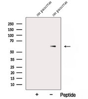 AMY2B Antibody - Western blot analysis of extracts of rat pancreas tissue using Amylase, alpha antibody. The lane on the left was treated with blocking peptide.