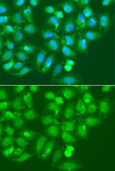 AMY2B Antibody - Immunofluorescence analysis of A549 cells using AMY2B Polyclonal Antibody.