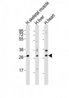 AMZ1 Antibody - All lanes : Anti-AMZ1 Antibody at 1:2000 dilution Lane 1: human skeletal muscle lysates Lane 2: human liver lysates Lane 3: human heart lysates Lysates/proteins at 20 ug per lane. Secondary Goat Anti-Rabbit IgG, (H+L), Peroxidase conjugated at 1/10000 dilution Predicted band size : 55 kDa Blocking/Dilution buffer: 5% NFDM/TBST.