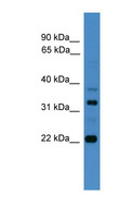 AMZ2 Antibody - AMZ2 antibody Western blot of RPMI-8226 cell lysate. This image was taken for the unconjugated form of this product. Other forms have not been tested.