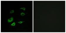 ANAPC1 / APC1 Antibody - Immunofluorescence analysis of HepG2 cells, using Cyclosome 1 Antibody. The picture on the right is blocked with the synthesized peptide.