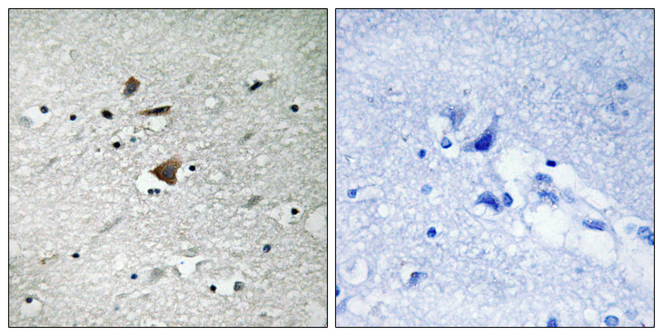 ANAPC1 / APC1 Antibody - Immunohistochemistry analysis of paraffin-embedded human brain tissue, using APC1 Antibody. The picture on the right is blocked with the synthesized peptide.