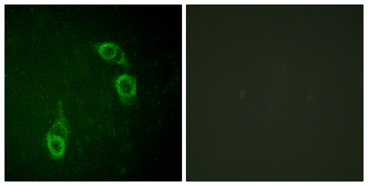 ANAPC1 / APC1 Antibody - Immunofluorescence analysis of HepG2 cells, using APC1 Antibody. The picture on the right is blocked with the synthesized peptide.