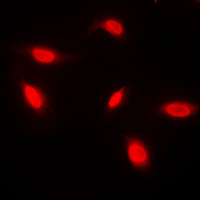ANAPC1 / APC1 Antibody - Immunofluorescent analysis of ANAPC1 staining in HeLa cells. Formalin-fixed cells were permeabilized with 0.1% Triton X-100 in TBS for 5-10 minutes and blocked with 3% BSA-PBS for 30 minutes at room temperature. Cells were probed with the primary antibody in 3% BSA-PBS and incubated overnight at 4 C in a humidified chamber. Cells were washed with PBST and incubated with a DyLight 594-conjugated secondary antibody (red) in PBS at room temperature in the dark. DAPI was used to stain the cell nuclei (blue).