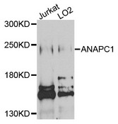 ANAPC1 / APC1 Antibody - Western blot analysis of extracts of various cells.
