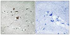 ANAPC1 / APC1 Antibody - Peptide - + Immunohistochemistry analysis of paraffin-embedded human brain tissue using APC1 antibody.