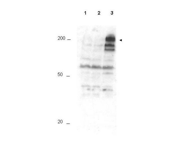 ANAPC1 / APC1 Antibody - Anti-APC1 pS355 Antibody - Western Blot. Western blot of Affinity Purified anti-APC1 pS355 antibody shows detection of a band ~215 kD corresponding to phosphorylated human APC1 (arrowhead). Lane 1 shows lysate from asynchronous cells. Lane 2 shows lysate from cells treated with thymidine to synchronize cells at the G1/S boundary. Lane 3 shows lysate from cells treated with nocodazole to synchronize cells at the M phase. Phosphorylated APC1 is mostly present only in cell preparations arrested at cell division. Each lane contains approximately 30 ug of HeLa S3 whole cell lysates separated by 12.5% SDS-PAGE followed by transfer to nitrocellulose. After blocking with 5% non-fat dry milk in TTBS, the membrane was probed with the primary antibody diluted to 1:500 for 1 h at room temperature followed by washes and reaction with a 1:5000 dilution of HRP Gt-a-Rabbit IgG [H&L] MX (LS-C60865) for 45 min at room temperature. ECL reagent was used for detection. Other detection systems will yield similar results. Data contributed by Bing Li, UT Southwestern.
