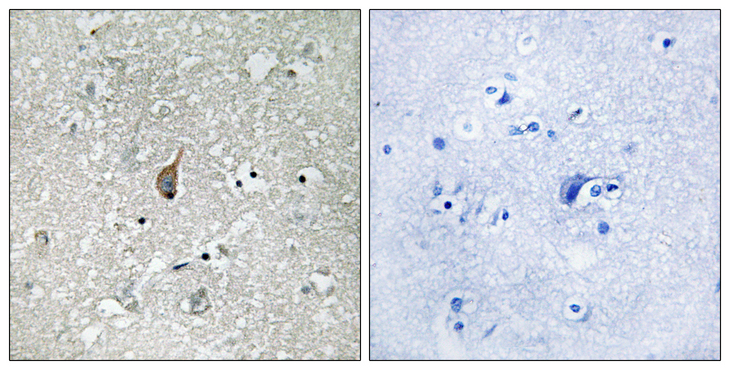 ANAPC1 / APC1 Antibody - Immunohistochemistry analysis of paraffin-embedded human brain, using APC1 (Phospho-Ser355) Antibody. The picture on the right is blocked with the phospho peptide.