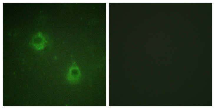 ANAPC1 / APC1 Antibody - Immunofluorescence analysis of COS7 cells, using APC1 (Phospho-Ser688) Antibody. The picture on the right is blocked with the phospho peptide.