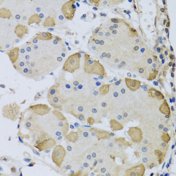 ANAPC10 / APC10 Antibody - Immunohistochemistry of paraffin-embedded human stomach tissue.