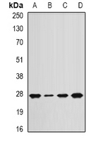 ANAPC10 / APC10 Antibody - Western blot analysis of APC10 expression in Jurkat (A); mouse lung (B); mouse spleen (C); rat heart (D) whole cell lysates.
