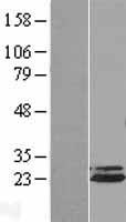 ANAPC10 / APC10 Protein - Western validation with an anti-DDK antibody * L: Control HEK293 lysate R: Over-expression lysate
