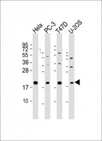 ANAPC11 / APC11 Antibody - All lanes: Anti-ANAPC11 Antibody (C-Term) at 1:2000 dilution Lane 1: Hela whole cell lysate Lane 2: PC-3 whole cell lysate Lane 3: T47D whole cell lysate Lane 4: U-2OS whole cell lysate Lysates/proteins at 20 µg per lane. Secondary Goat Anti-Rabbit IgG, (H+L), Peroxidase conjugated at 1/10000 dilution. Predicted band size: 10 kDa Blocking/Dilution buffer: 5% NFDM/TBST.