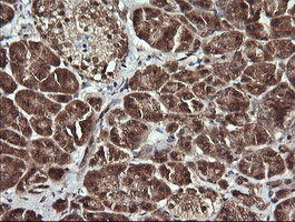 ANAPC11 / APC11 Antibody - IHC of paraffin-embedded Human pancreas tissue using anti-ANAPC11 mouse monoclonal antibody. (Heat-induced epitope retrieval by 10mM citric buffer, pH6.0, 120°C for 3min).